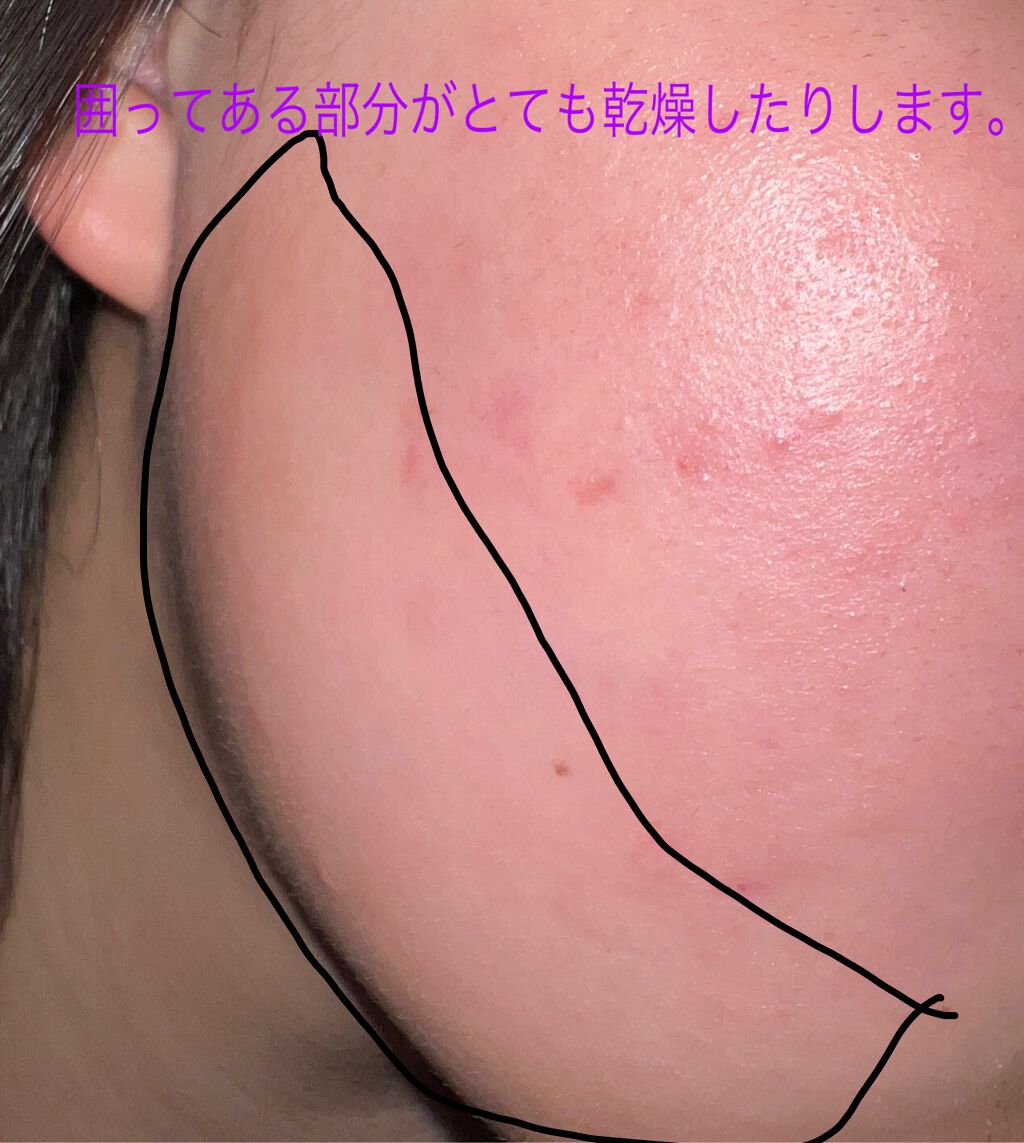 ミノン アミノモイスト モイストチャージ ミルク/ミノン/乳液を使ったクチコミ(2枚目)