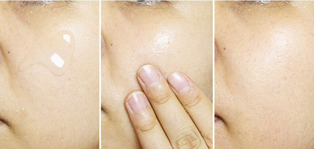  オールインワン リカバリー スパ エッセンス/FEDORA AESTHETIC/美容液を使ったクチコミ（1枚目）