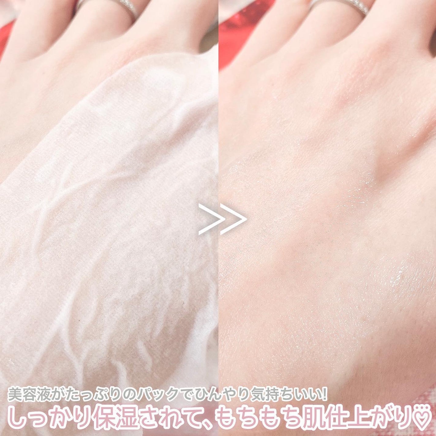 ビタ ジェニックゼリーマスク/BANOBAGI/シートマスク・パックを使ったクチコミ(6枚目)