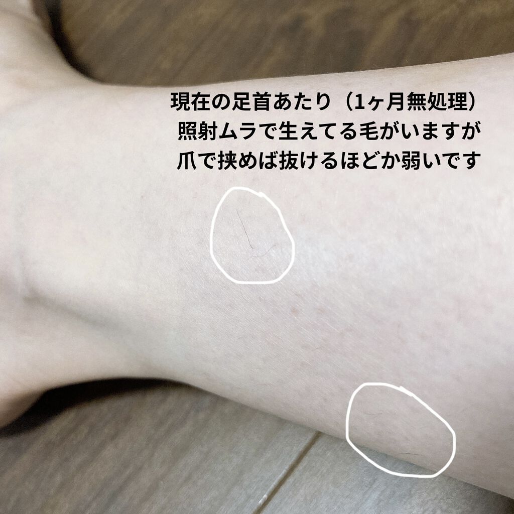 レビューで送料無料】 マサナカパナソニック 光美容器 光エステ ボディ