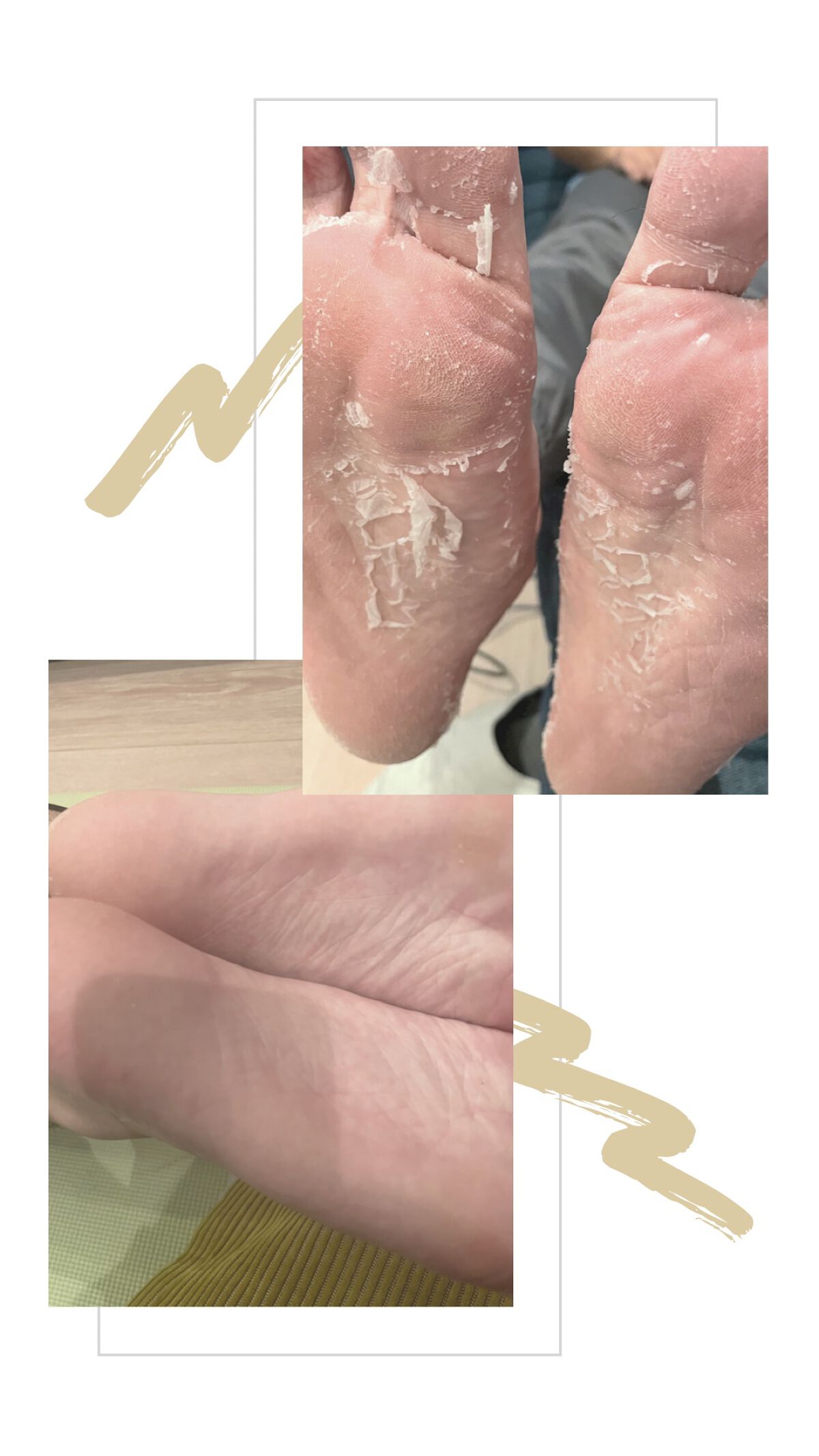 APフェイス＆ボディクリーム/ケアセラ/フェイスクリームを使ったクチコミ（2枚目）