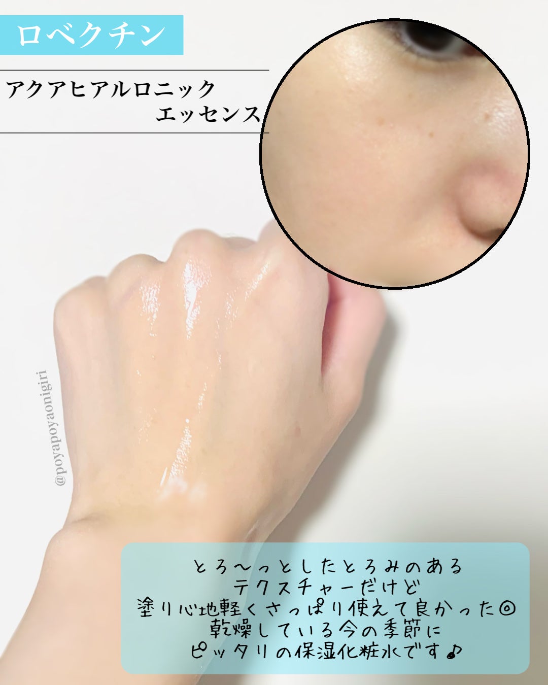 アクアヒアルロニックエッセンス/ロベクチン/化粧水を使ったクチコミ(3枚目)