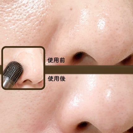 チョコブラ スペシャル毛穴ケアセット/Chocobra/スキンケアキットを使ったクチコミ(8枚目)