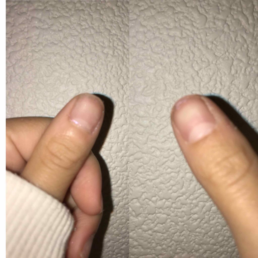 ノンアセトンネイルリムーバー/DAISO/除光液を使ったクチコミ(3枚目)