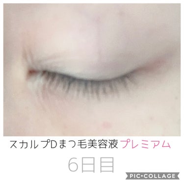 ダブルホワイト 薬用美白モイストローション(セット)/POND'S/スキンケアキットを使ったクチコミ（6枚目）