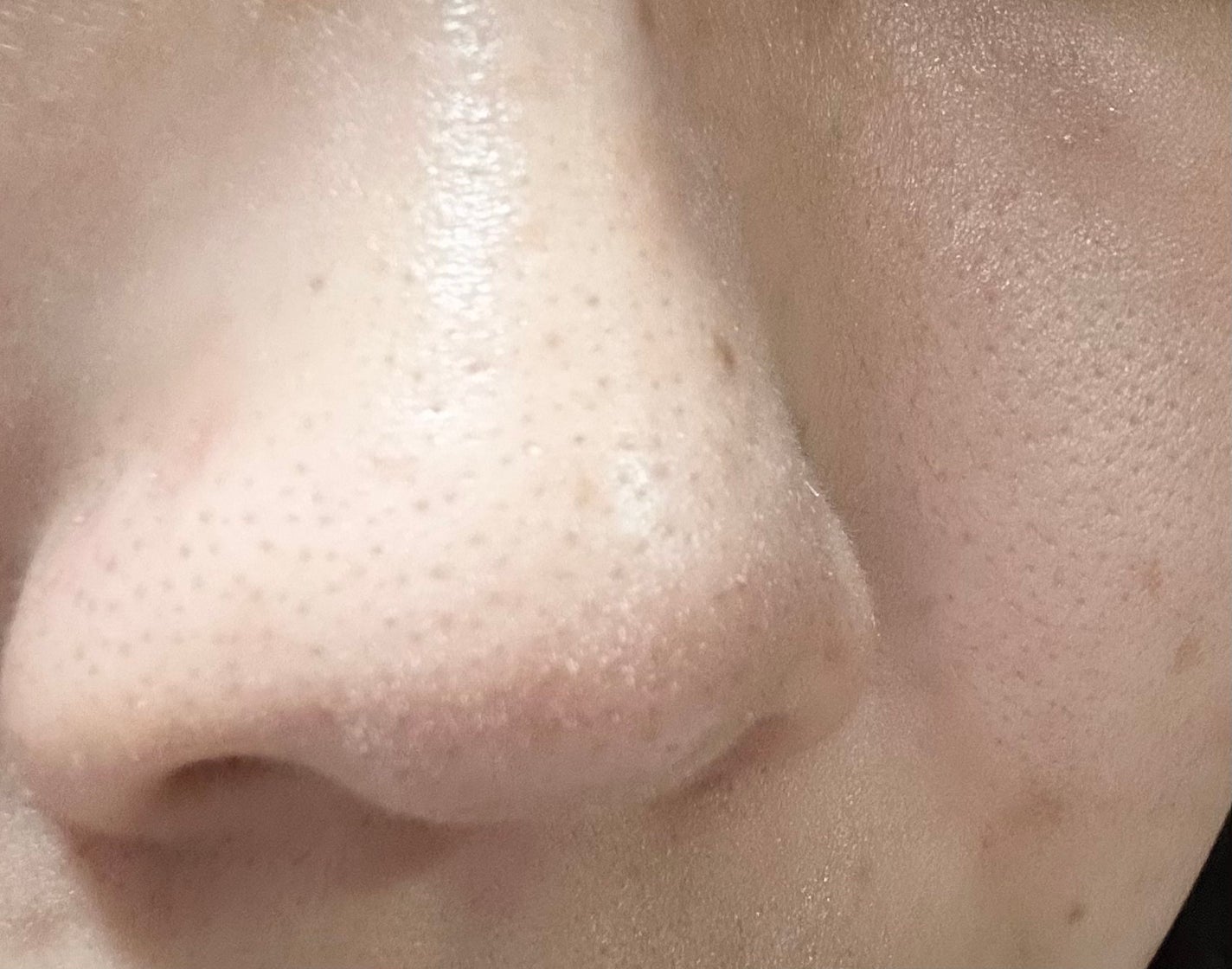 夜薙 @フォロバ on LIPS 「初投稿失礼します!今日はQoo10にてクレンジングを購入したの..」(2枚目)