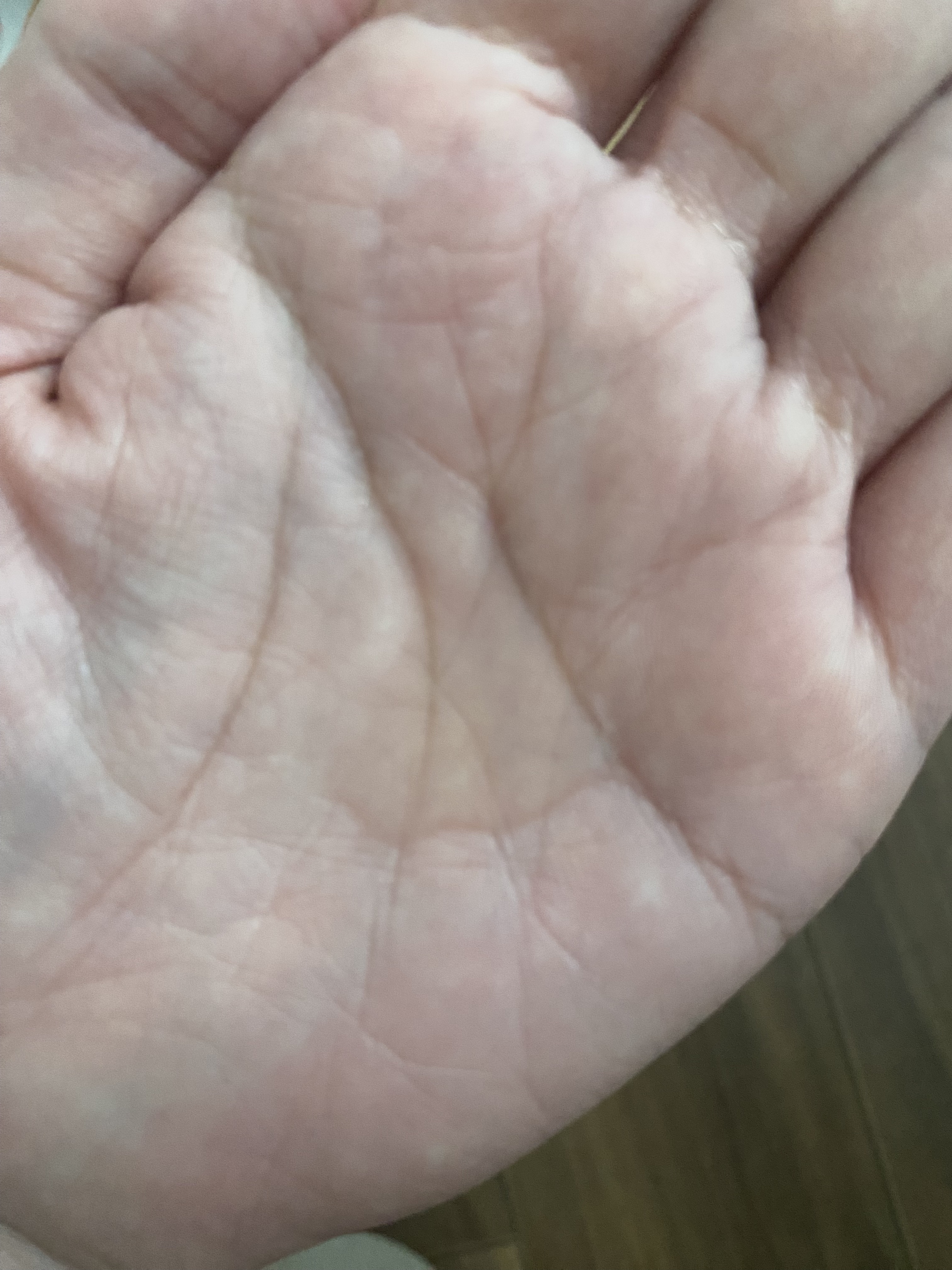 センテラ アンプル/SKIN1004/美容液を使ったクチコミ（2枚目）