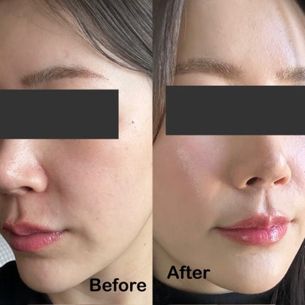 エスポア ビーグロー ボリュームクッション/espoir/クッションファンデーションを使ったクチコミ(5枚目)