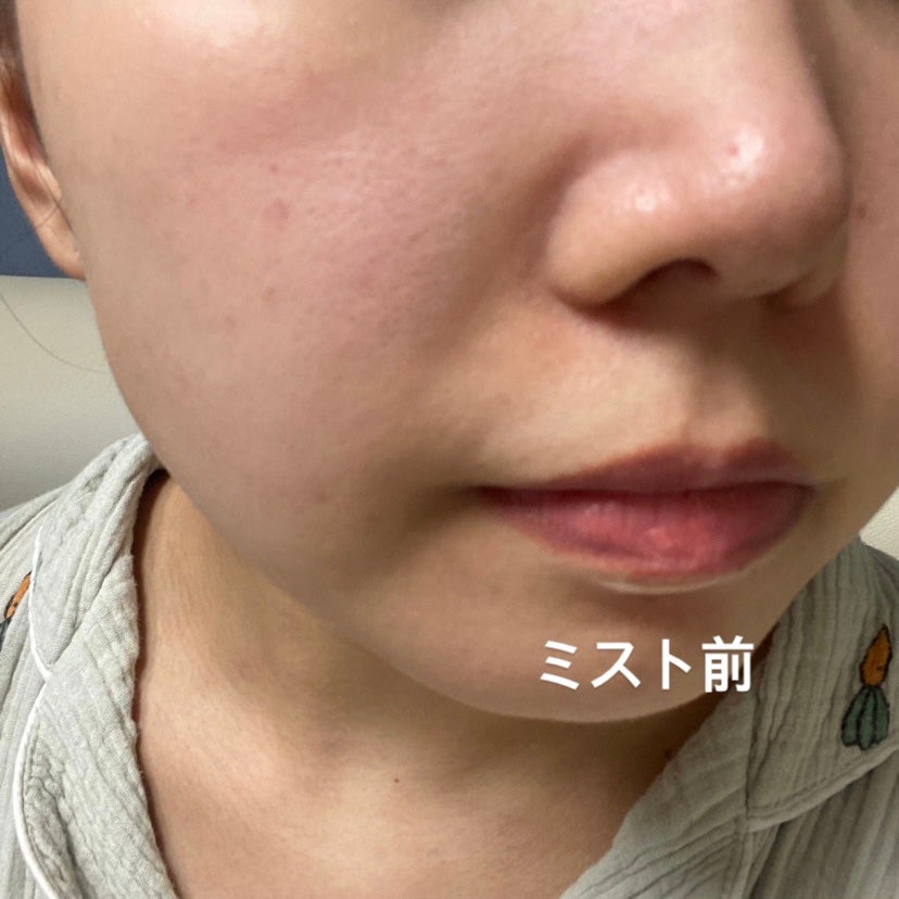 フェイシャルブースティングスパ/Makeon/美顔器・マッサージを使ったクチコミ(6枚目)