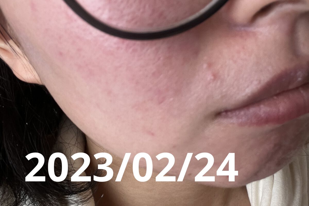 マジックカタツムリクリーム/ブラン/フェイスクリームを使ったクチコミ（2枚目）