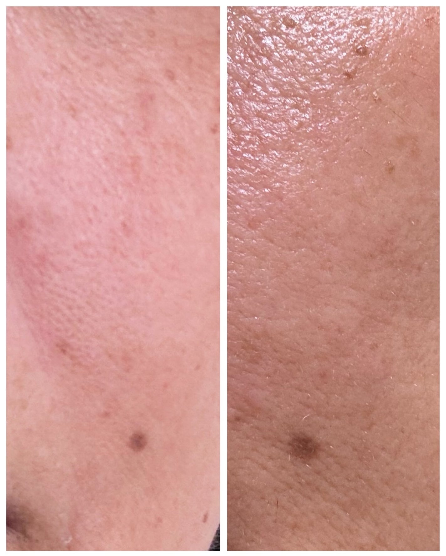 メープルエナジーインフュージングセラム/Klairs/美容液を使ったクチコミ(9枚目)