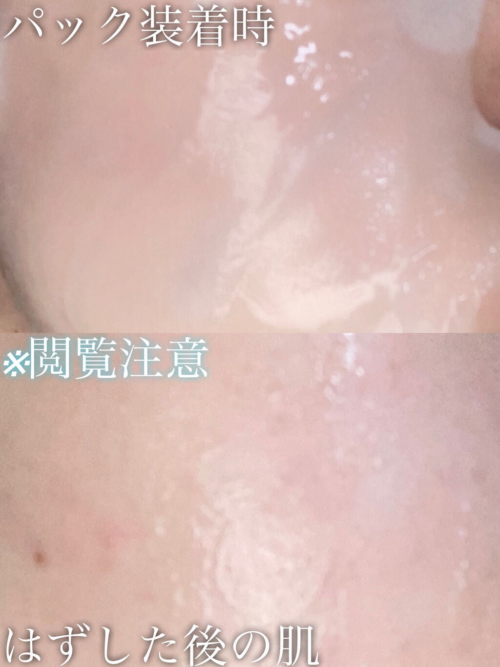 ビタ ジェニックゼリーマスク/BANOBAGI/シートマスク・パックを使ったクチコミ(2枚目)