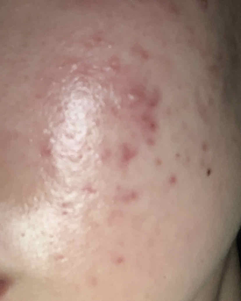 キールズ DS クリアリーブライト エッセンス[医薬部外品]/Kiehl's/美容液を使ったクチコミ（3枚目）