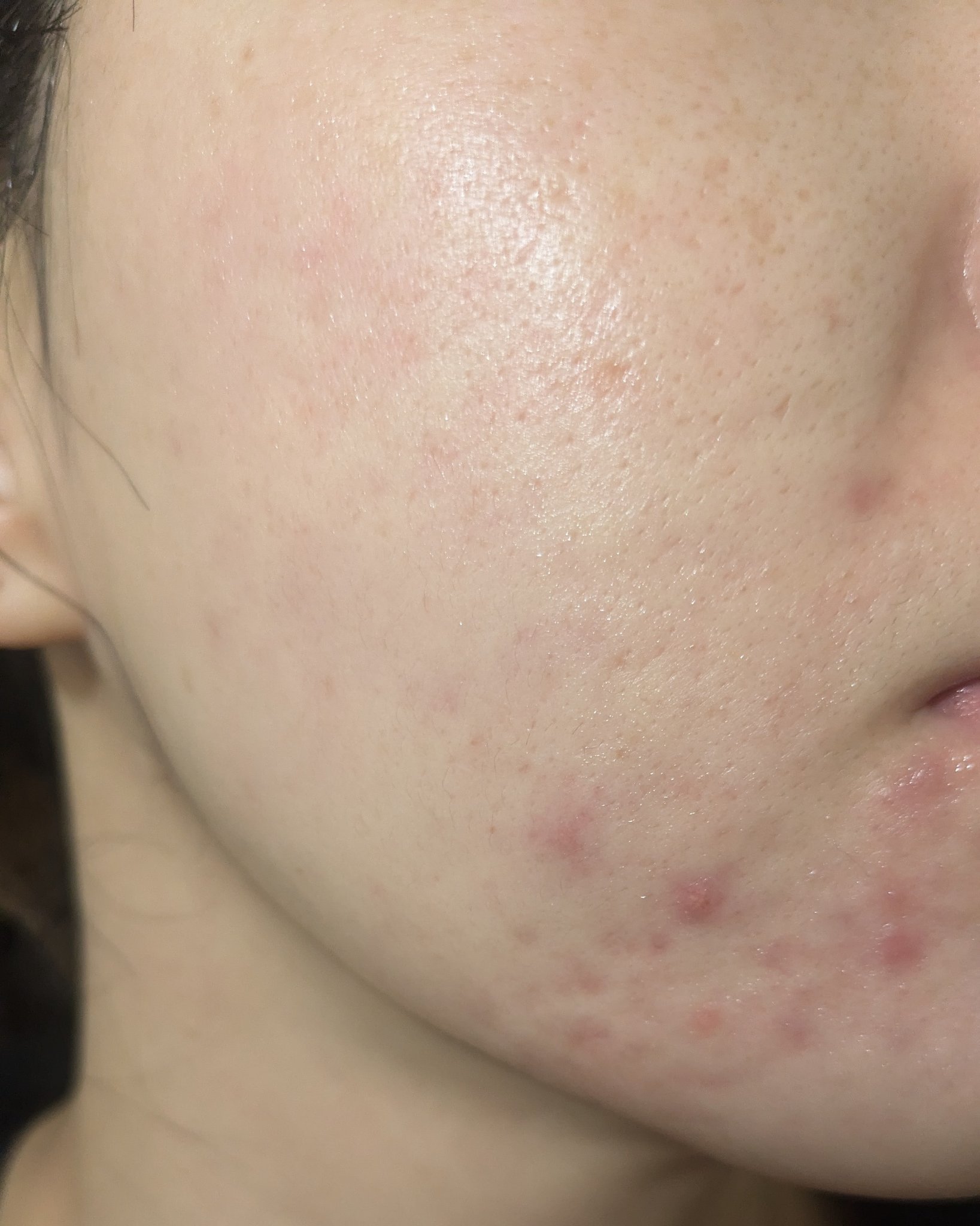 11/9の#汚肌工事録