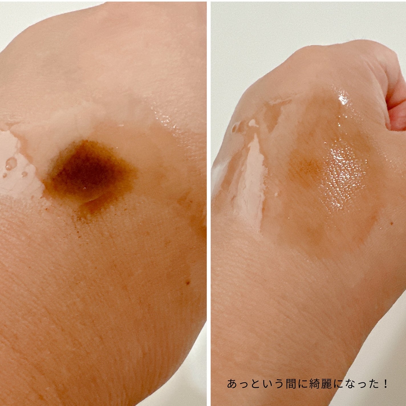 ブラックライス モイスチャー ディープクレンジングオイル/haruharu wonder/オイルクレンジングを使ったクチコミ(5枚目)