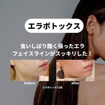 oto|好きを育てるメイクレシピ on LIPS 「美容課金、これはやって良かったというものを🙋内服は実はかなりサ..」(6枚目)