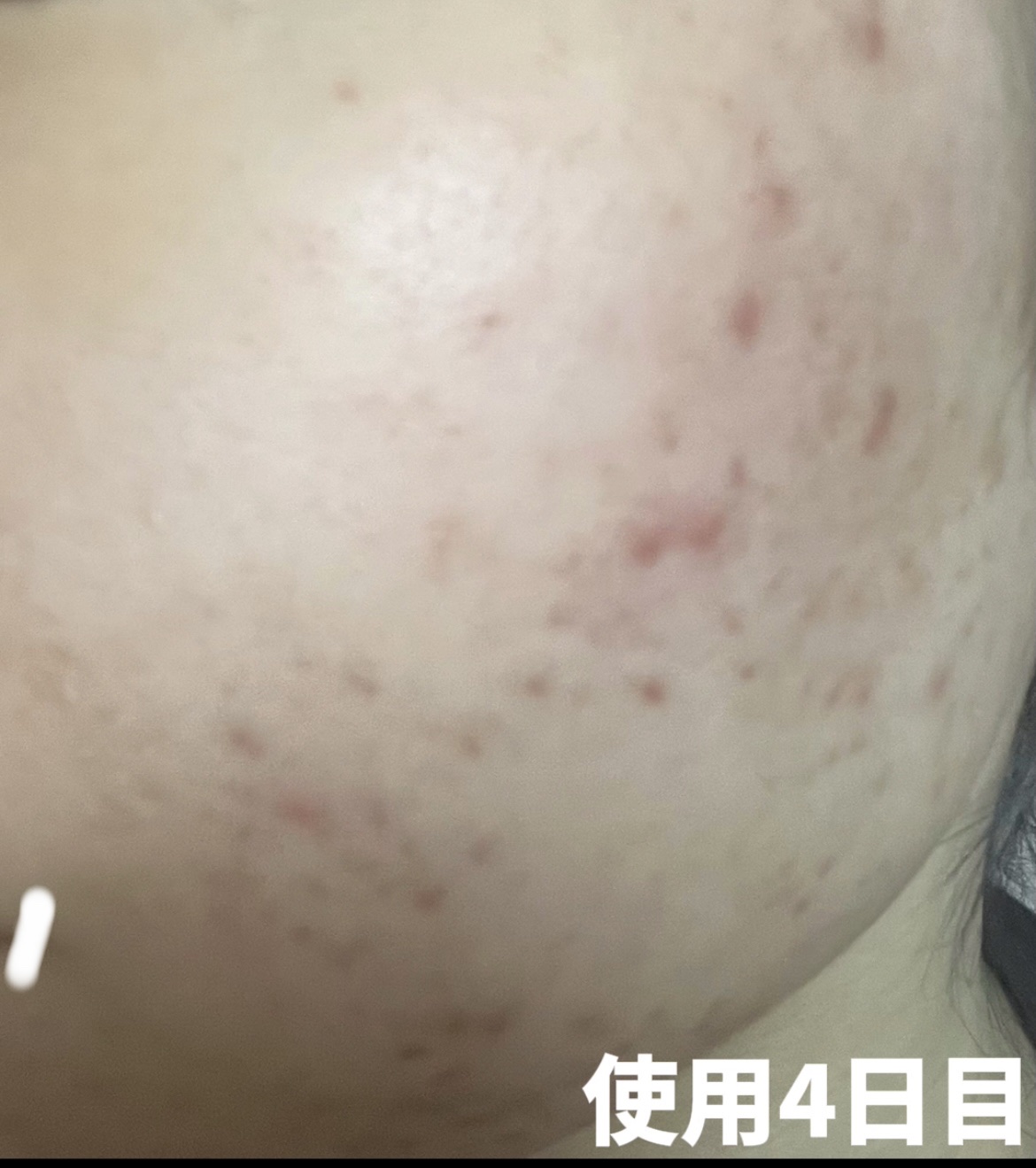 クリアフル トライアルセット L/オルビス/トライアルキットを使ったクチコミ（3枚目）