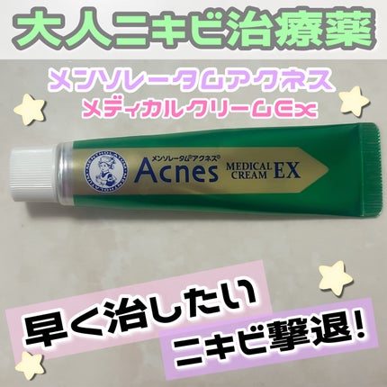 ã¡ã³ãœã¬ãŒã¿ã ã¢ã¯ãã¹25 ã¡ãã£ã«ã«ã¯ãªãŒã EXa(å»è¬å)/ã¡ã³ãœã¬ãŒã¿ã ã¢ã¯ãã¹25/ãã®ä»ã䜿ã£ãã¯ãã³ãïŒ1æç®ïŒ