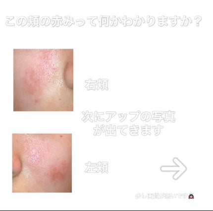 薬用しみ対策 美白化粧水/メラノCC/化粧水を使ったクチコミ(1枚目)