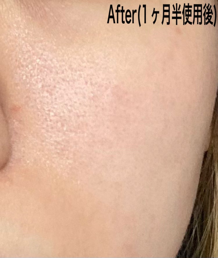 グロウドロップス/FEMMUE/美容液を使ったクチコミ(4枚目)