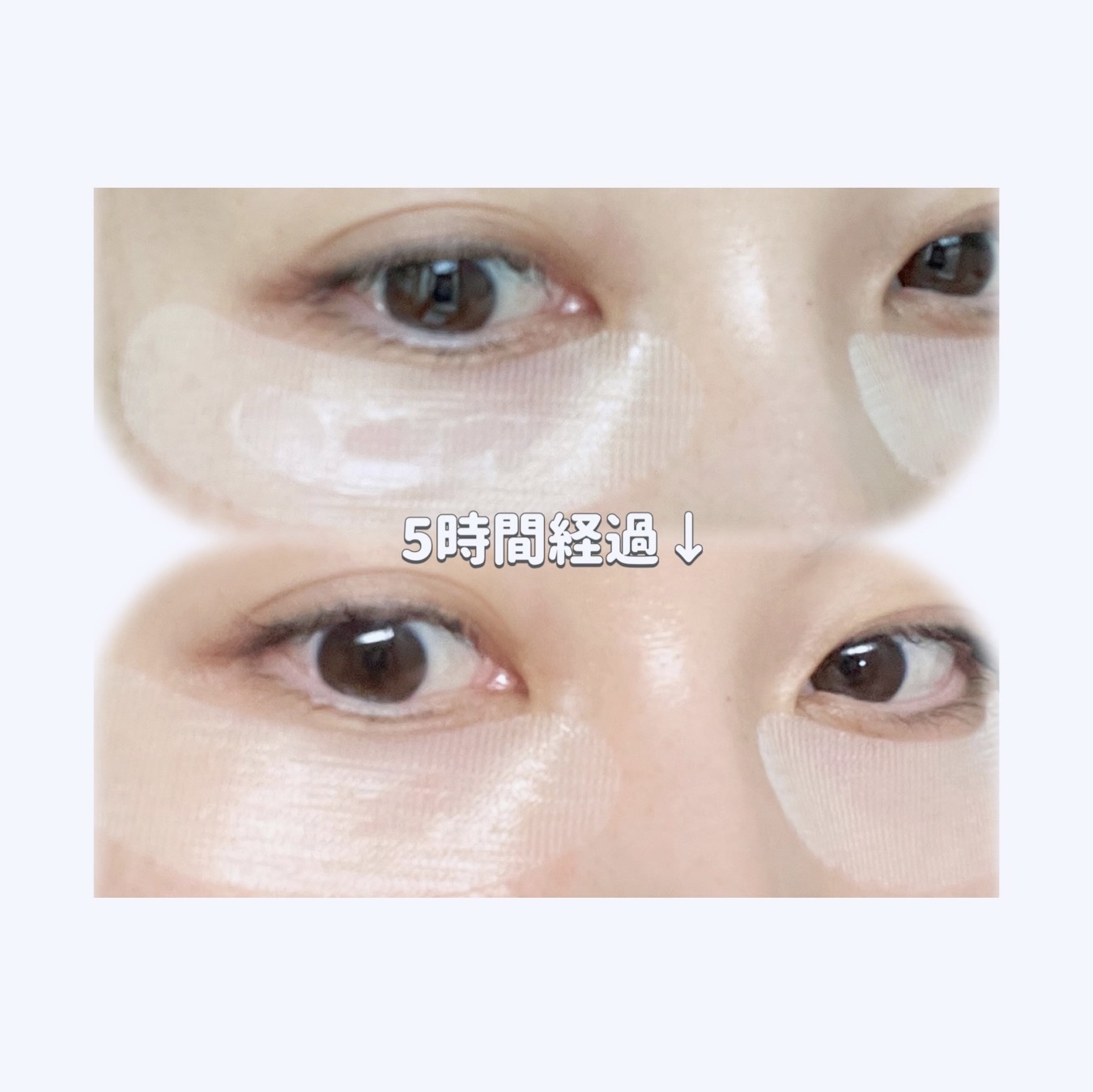 ナイトセラムパッチ/GOKUMIN/シートマスク・パックを使ったクチコミ（3枚目）