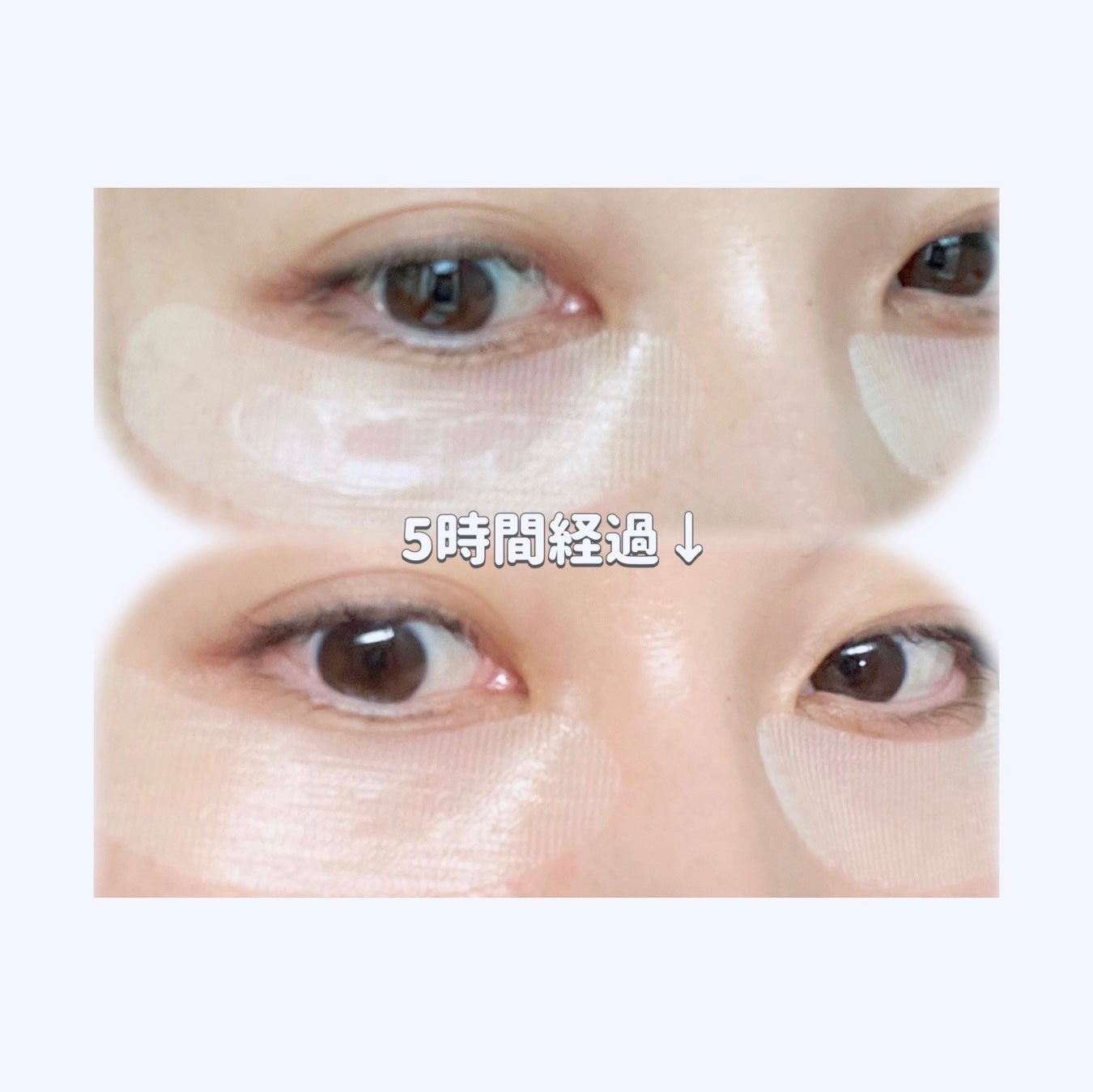 ナイトセラムパッチ/GOKUMIN/シートマスク・パックを使ったクチコミ(3枚目)