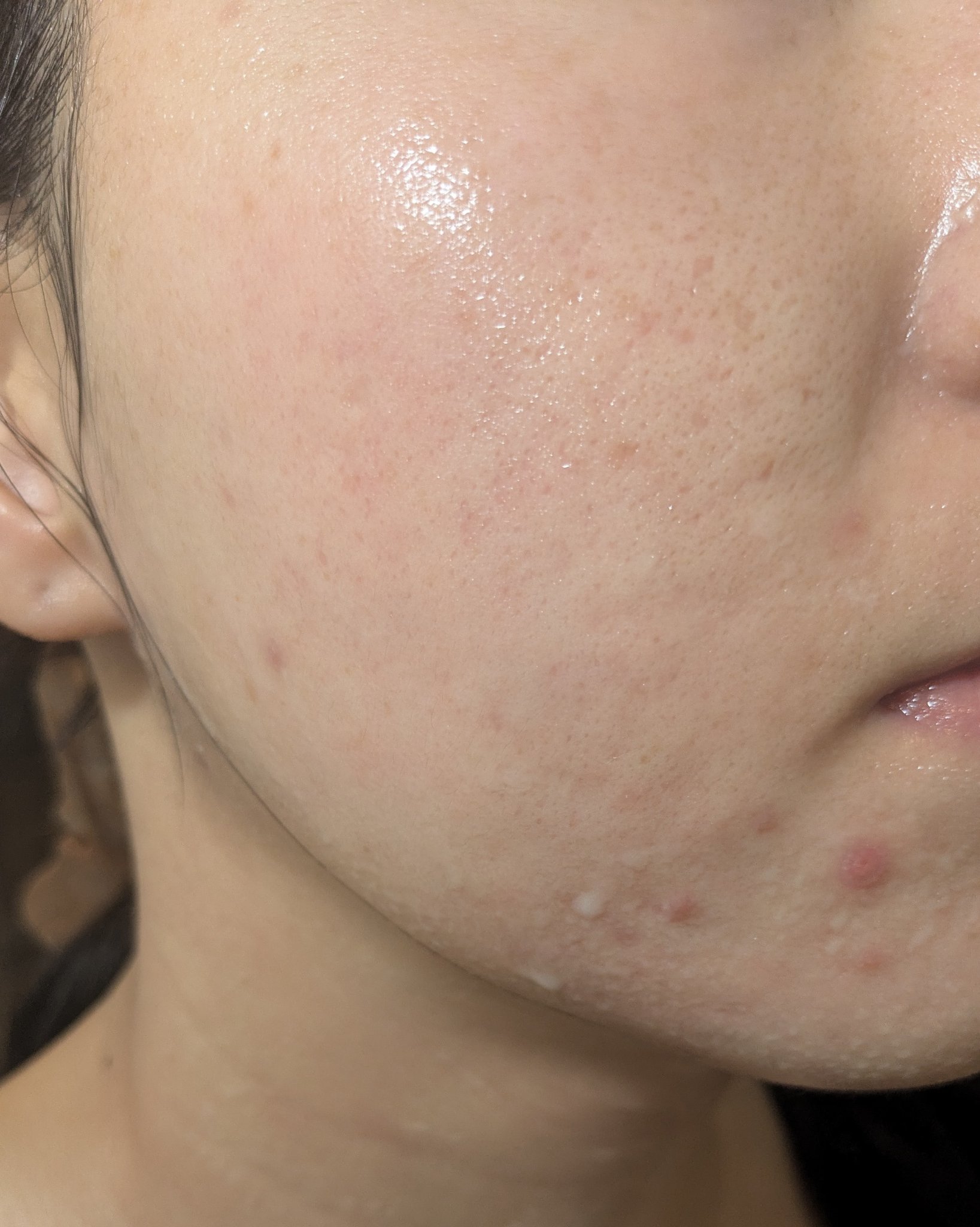 KOMBUCHA（コンブチャ）/仙台勝山館/コンブチャを使ったクチコミ（1枚目）