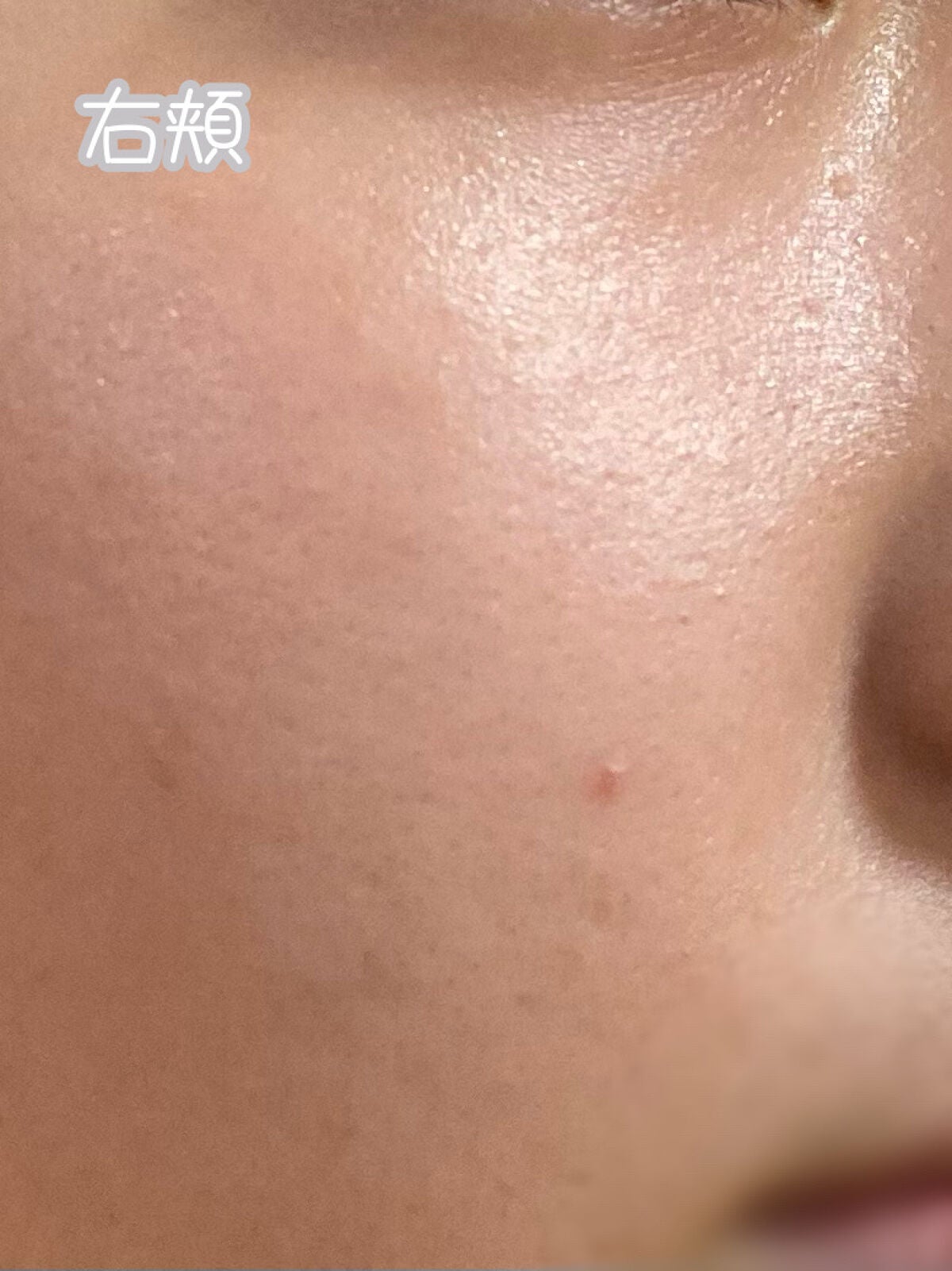 薬用しみ対策 美白化粧水 しっとりタイプ/メラノCC/化粧水を使ったクチコミ(4枚目)