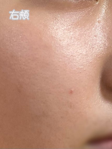 薬用しみ対策 美白化粧水 しっとりタイプ/メラノCC/化粧水を使ったクチコミ(4枚目)