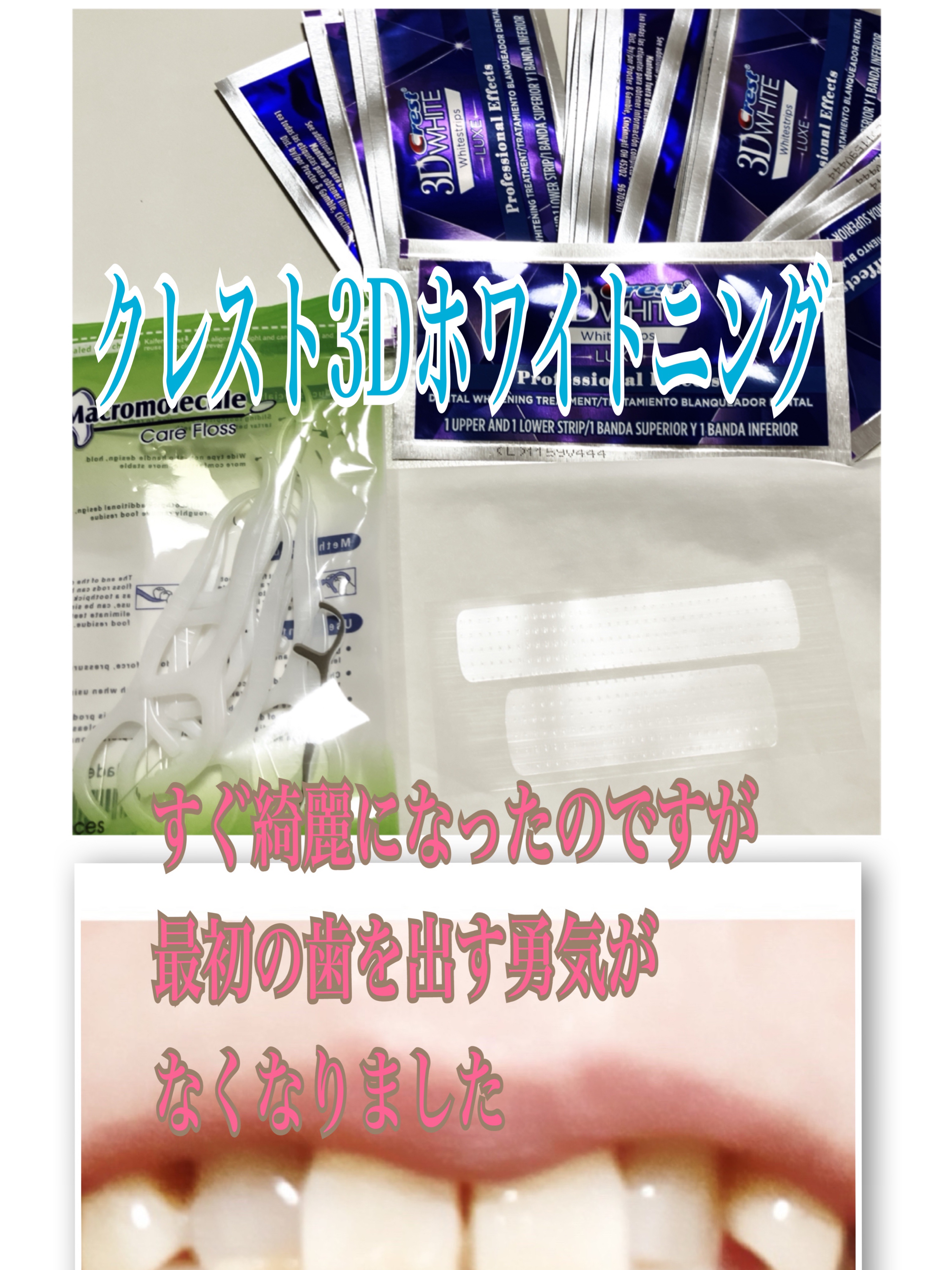 クレスト3Dホワイトニング ホワイトストリップ プロフェッショナル エフェクツ/クレスト/その他オーラルケアを使ったクチコミ（1枚目）