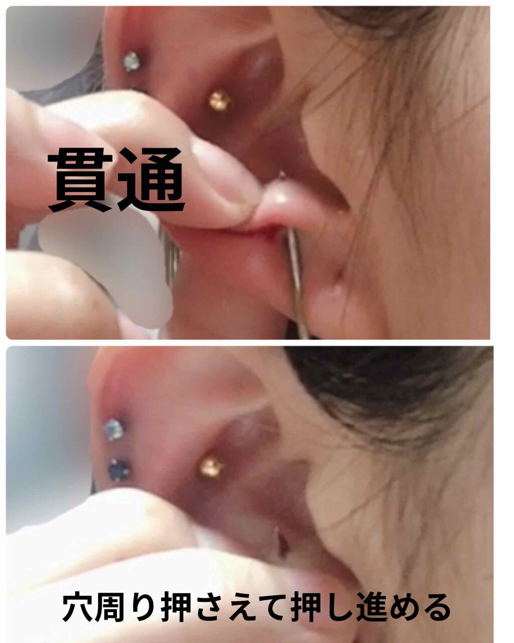 みずみ on LIPS 「⚠️ピアッシングレポです。苦手な人はご注意を👂アンチトラガス開..」(3枚目)