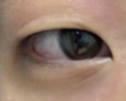 アイビューティー フィクサー WP/アストレア ヴィルゴ/二重まぶた用アイテムを使ったクチコミ(2枚目)