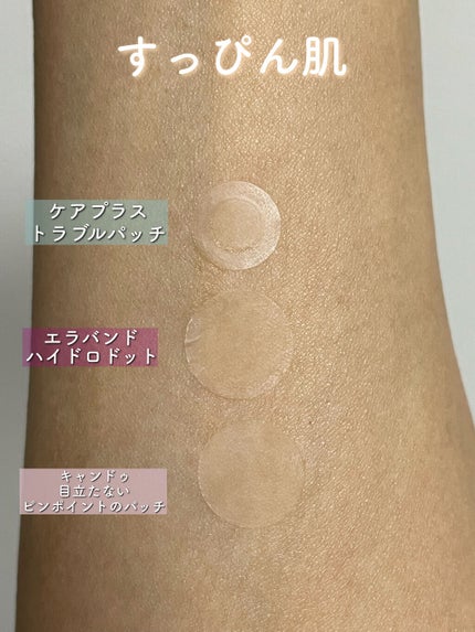 エラバンドパッチ/ElaBAND/その他を使ったクチコミ(3枚目)