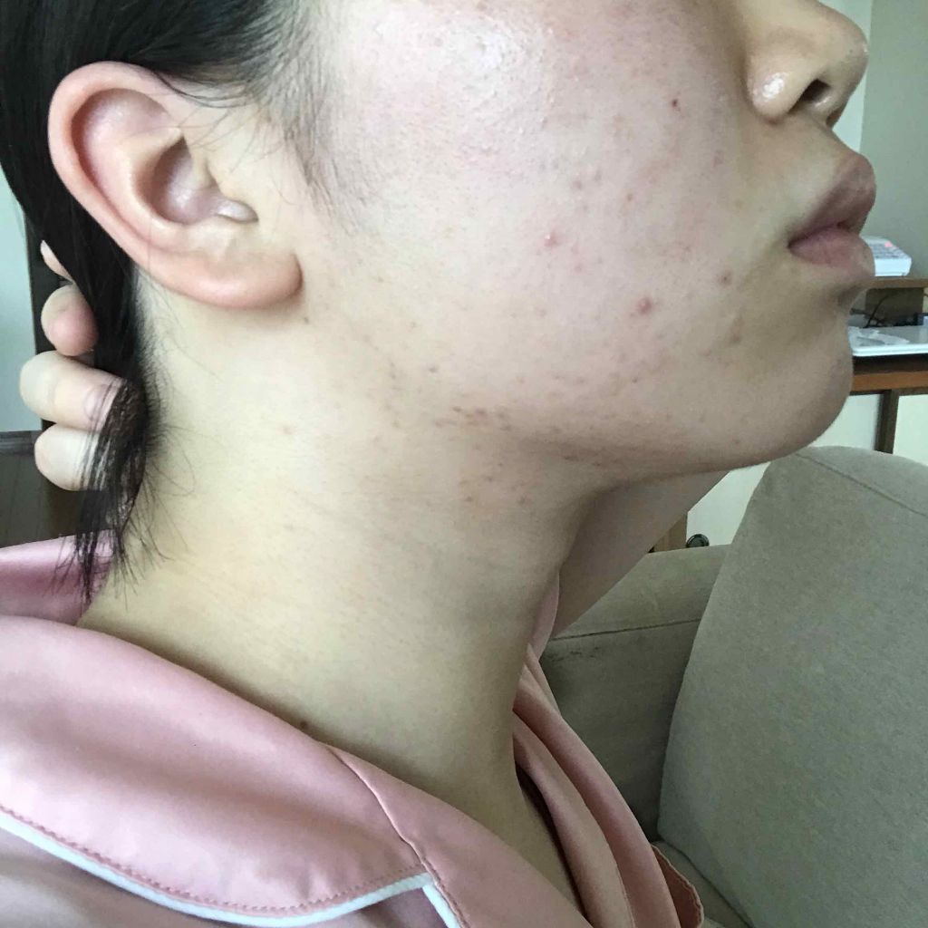 有村架純になりたいJ K② on LIPS 「なんだか一向に良くならないですもうどうすればいいのかわからない..」(4枚目)