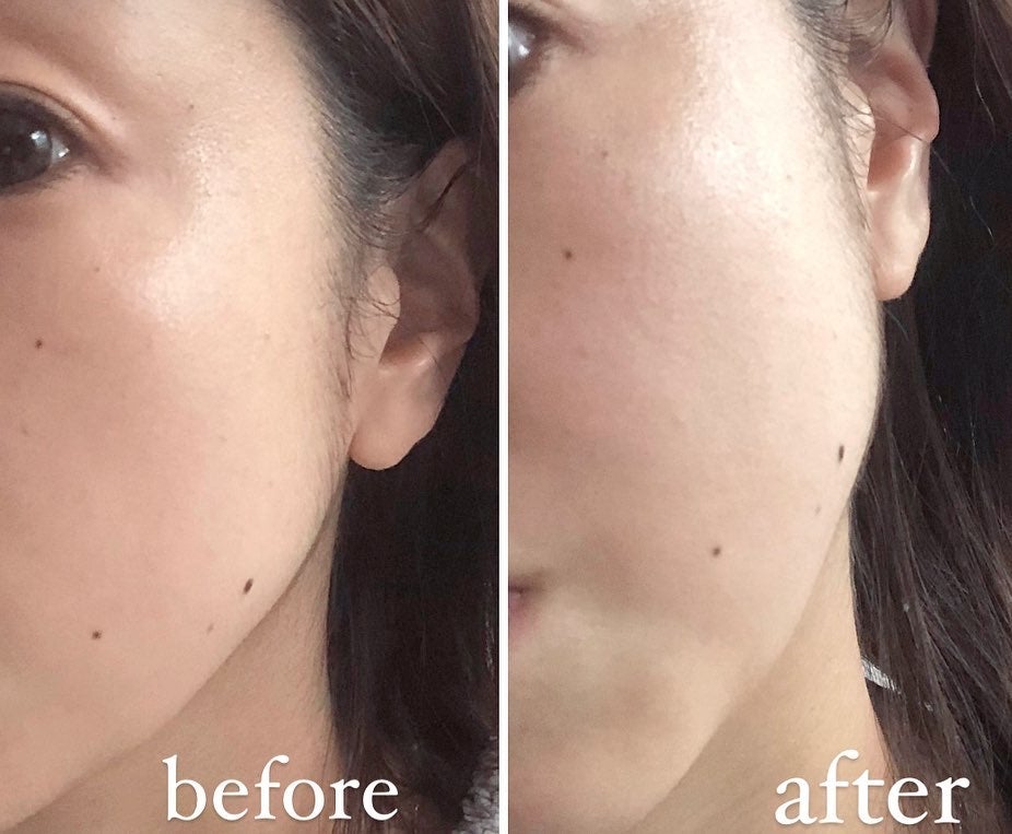 9番 NMNバイオリフトラッピングマスク/numbuzin/シートマスク・パックを使ったクチコミ(6枚目)