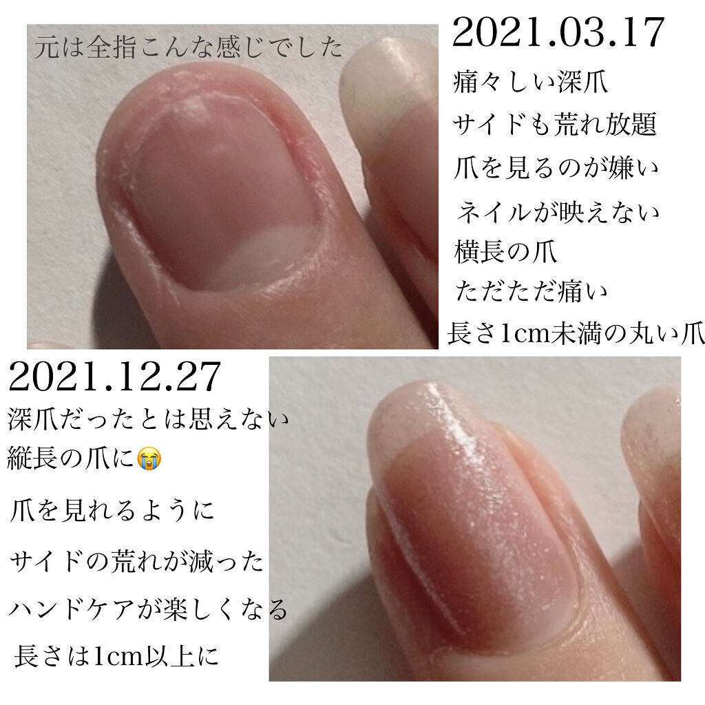 ネイルオイル/ベリンダ/ネイルオイル・トリートメントを使ったクチコミ(4枚目)