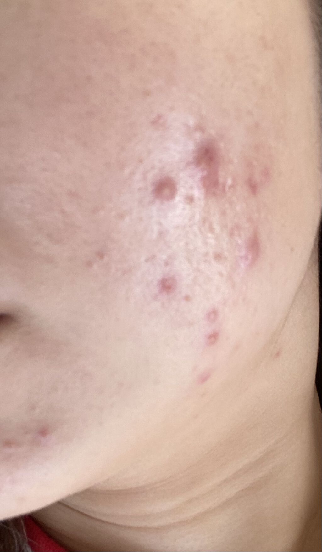 モイスチュア ローション/カルテHD/化粧水を使ったクチコミ（2枚目）