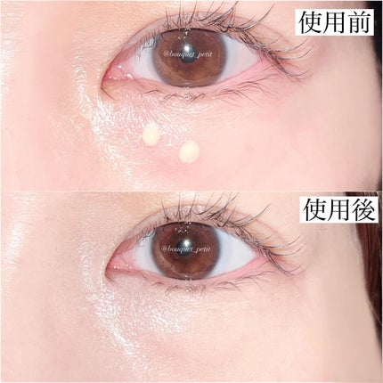 アイレノール クマクリーム/IRENOL/アイケア・アイクリームを使ったクチコミ(5枚目)