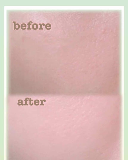 小豆島ルルルン オリーブマスク/ルルルン/シートマスク・パックを使ったクチコミ(2枚目)