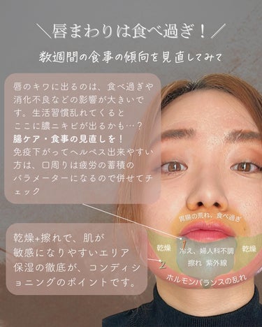 おゆみ|ニキビ・ニキビ跡ケア on LIPS 「@______ohyoume　他の投稿はこちらから👋✨こんばん..」（3枚目）