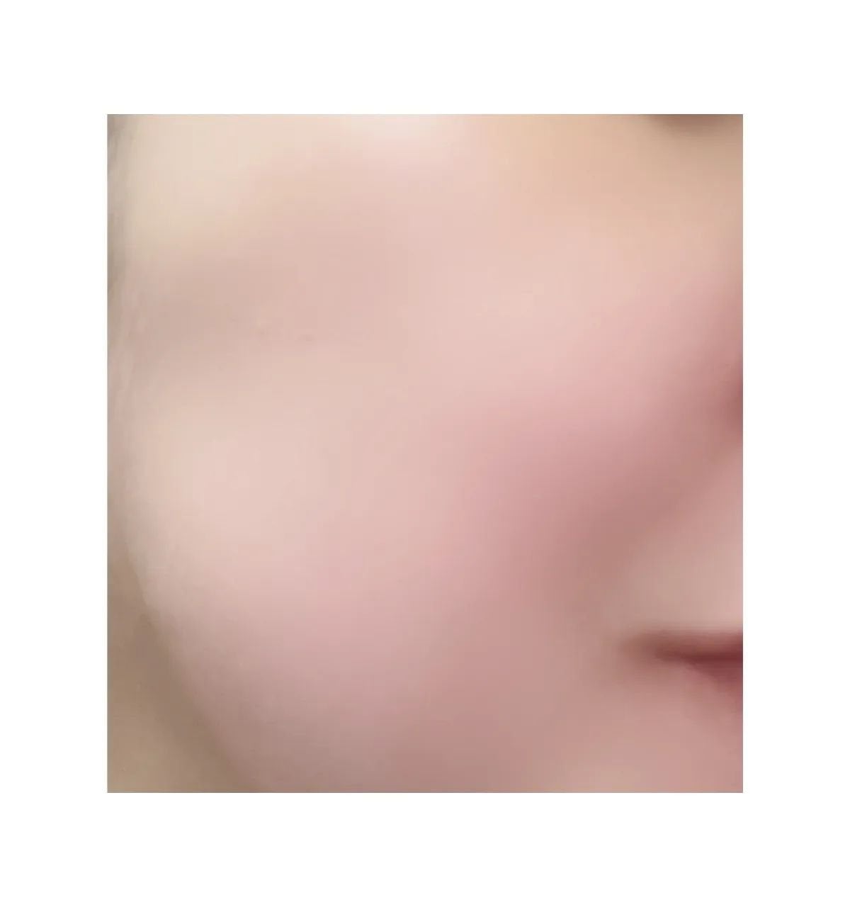 アトバリア365クリーム/AESTURA/フェイスクリームを使ったクチコミ(3枚目)