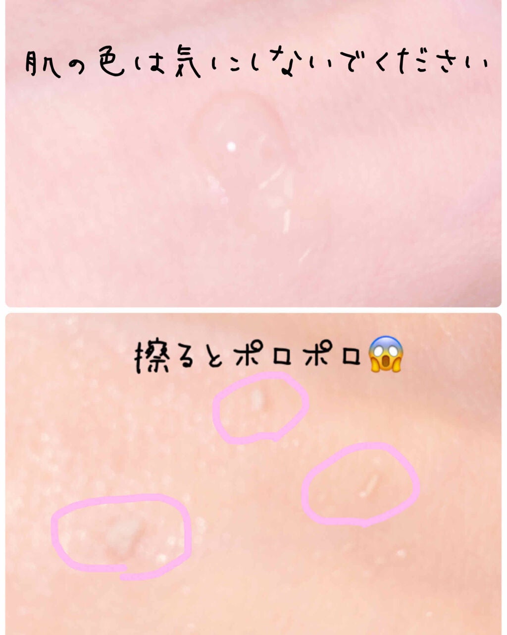 DETクリア ブライト&ピール ピーリングジェリー<無香料タイプ>/Detclear/ピーリングを使ったクチコミ(2枚目)