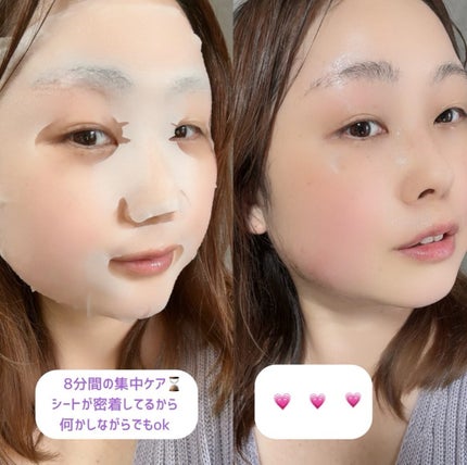 ごめんね素肌マスク/クリアターン/シートマスク・パックを使ったクチコミ(6枚目)