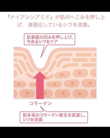 Wエフェクト アイクリーム /RF28/アイケア・アイクリームを使ったクチコミ(6枚目)