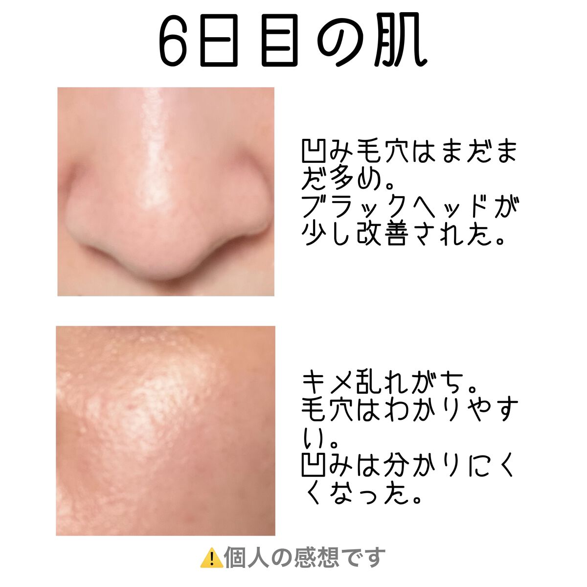 RXザ・レチノール0.1クリーム/COSRX/フェイスクリームを使ったクチコミ（3枚目）