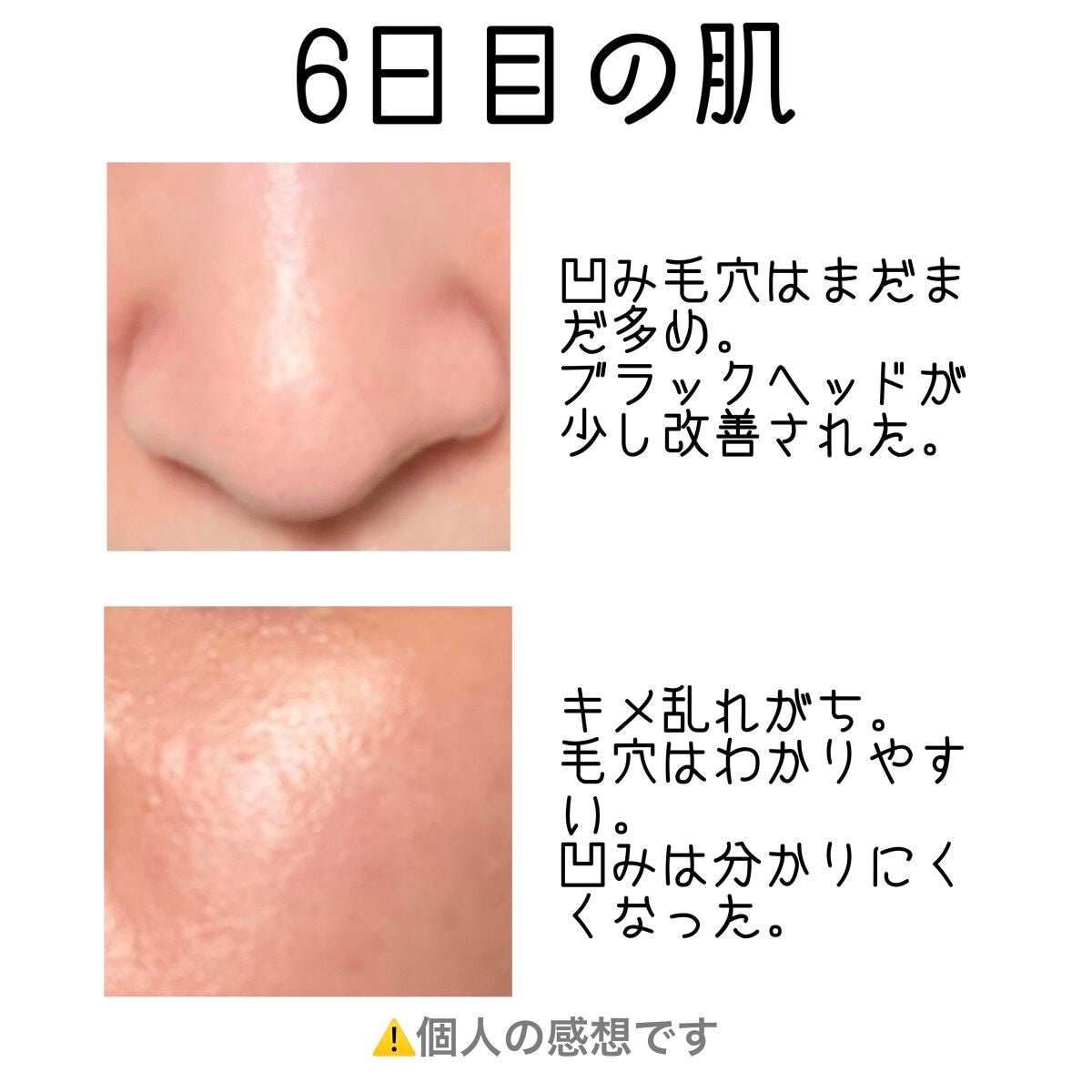 RXザ・レチノール0.1クリーム/COSRX/フェイスクリームを使ったクチコミ(3枚目)