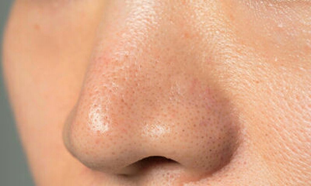 ソフティモ ディープ クレンジングオイル/ソフティモ/オイルクレンジングを使ったクチコミ(1枚目)