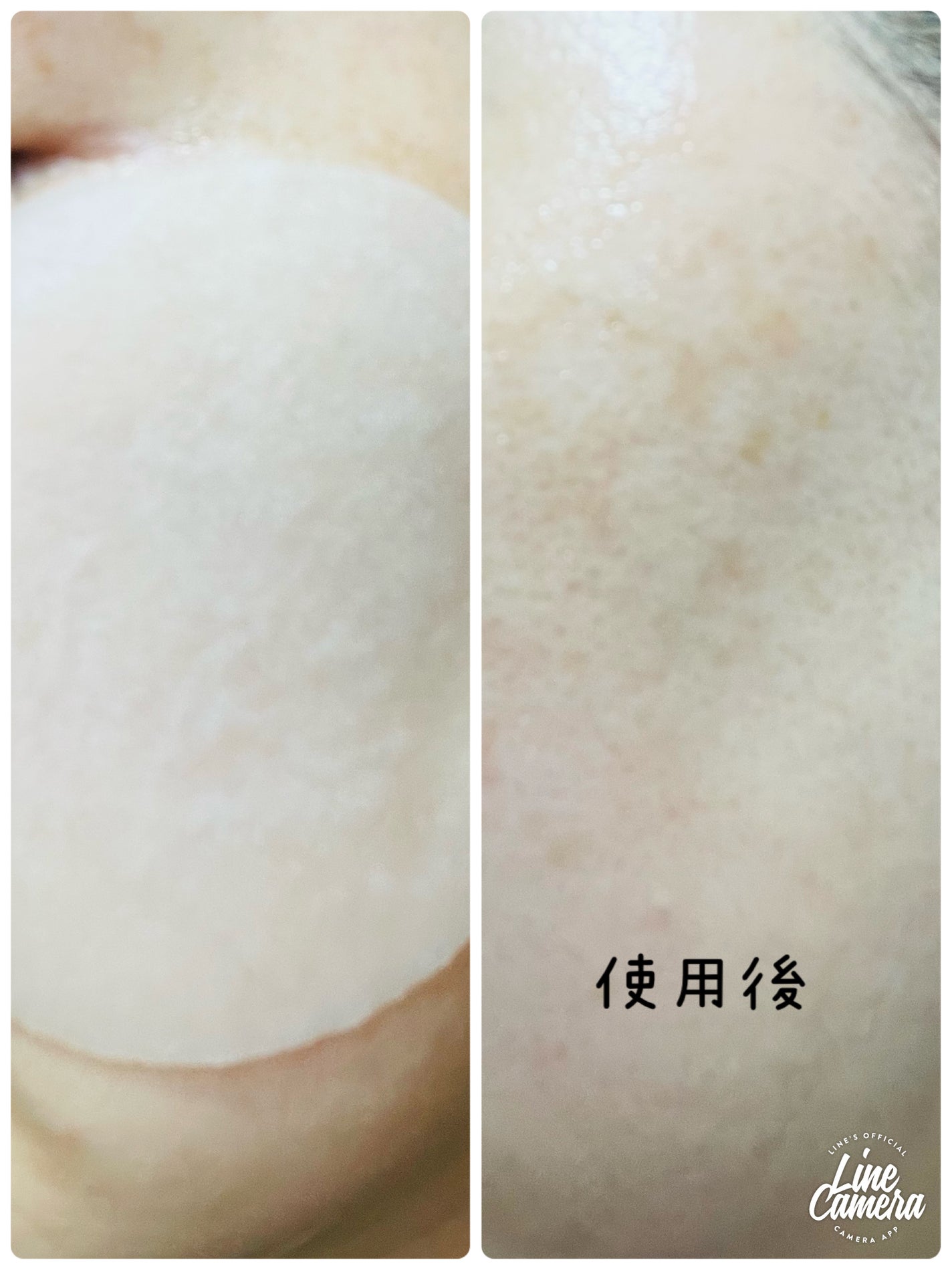 アビブ グルタチオンソームダークスポットセラムビタドロップ/Abib /美容液を使ったクチコミ(3枚目)