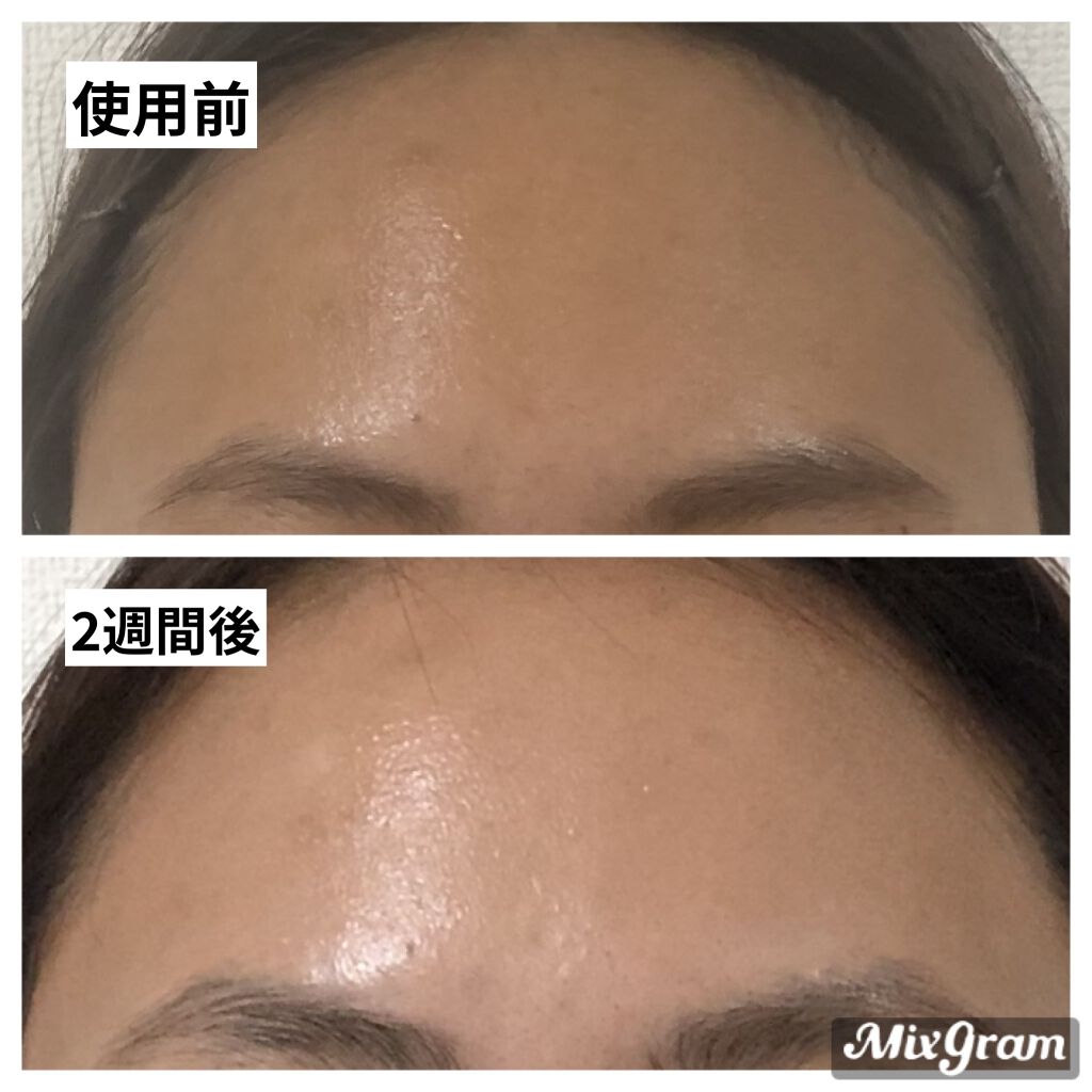 SCセラム/Natura/ブースター・導入液を使ったクチコミ（2枚目）