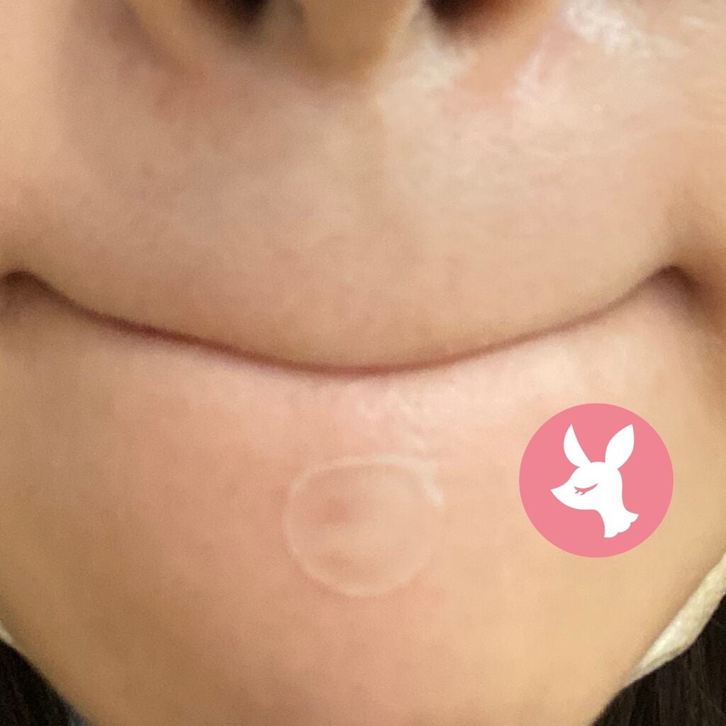 ゼロスポットシカクリーム/Today’s Cosme/フェイスクリームを使ったクチコミ(4枚目)